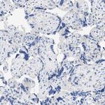 SLN13 Antibody in Immunohistochemistry (Paraffin) (IHC (P))