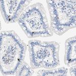 SLN13 Antibody in Immunohistochemistry (Paraffin) (IHC (P))
