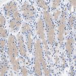 SLN13 Antibody in Immunohistochemistry (Paraffin) (IHC (P))