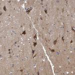 TSTD2 Antibody in Immunohistochemistry (Paraffin) (IHC (P))