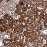 TSTD2 Antibody in Immunohistochemistry (Paraffin) (IHC (P))