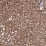 TSTD2 Antibody in Immunohistochemistry (Paraffin) (IHC (P))