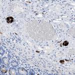 ANKFN1 Polyclonal Antibody