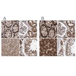 PECR Polyclonal Antibody