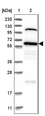 TOM1L2 Antibody in Western Blot (WB)