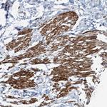 FAM187A Antibody in Immunohistochemistry (Paraffin) (IHC (P))