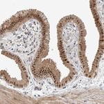 MSL1 Antibody in Immunohistochemistry (IHC)
