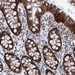 BZW2 Antibody in Immunohistochemistry (Paraffin) (IHC (P))