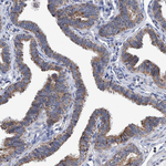 BZW2 Antibody in Immunohistochemistry (Paraffin) (IHC (P))