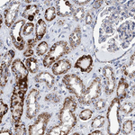BZW2 Antibody in Immunohistochemistry (Paraffin) (IHC (P))