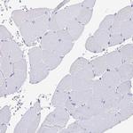 Laminin gamma-3 Antibody in Immunohistochemistry (Paraffin) (IHC (P))
