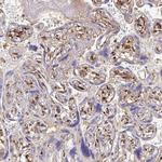 Laminin gamma-3 Antibody in Immunohistochemistry (IHC)
