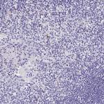 Laminin gamma-3 Antibody in Immunohistochemistry (IHC)