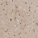 MRCK beta Antibody in Immunohistochemistry (IHC)