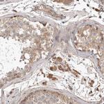 MRCK beta Antibody in Immunohistochemistry (IHC)