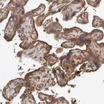 MRCK beta Polyclonal Antibody