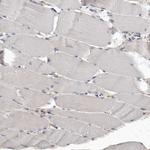 MRCK beta Antibody in Immunohistochemistry (IHC)