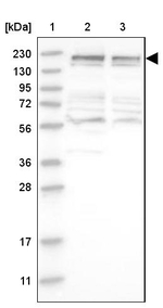 MRCK beta Antibody in Western Blot (WB)