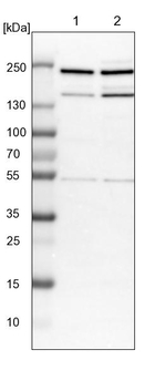 MRCK beta Antibody in Western Blot (WB)