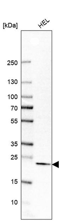 ITPA Antibody in Western Blot (WB)