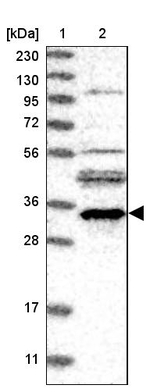 TTC35 Antibody in Western Blot (WB)