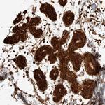 EXOC7 Antibody in Immunohistochemistry (Paraffin) (IHC (P))