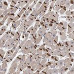 KRBA2 Antibody in Immunohistochemistry (Paraffin) (IHC (P))