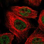 KRBA2 Polyclonal Antibody