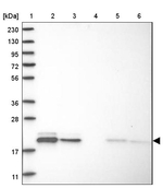 MRPL12 Antibody in Western Blot (WB)