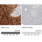 HRSP12 Antibody in Immunohistochemistry (IHC)