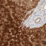 HRSP12 Antibody in Immunohistochemistry (IHC)