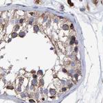 EFR3A Antibody in Immunohistochemistry (IHC)