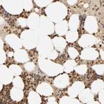 AARSD1 Antibody in Immunohistochemistry (Paraffin) (IHC (P))