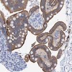 JAKMIP3 Polyclonal Antibody