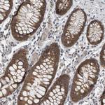 CoA Synthase Antibody in Immunohistochemistry (Paraffin) (IHC (P))