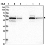 CoA Synthase Antibody in Western Blot (WB)