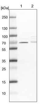 CDK5RAP3 Antibody in Western Blot (WB)