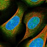 GARNL4 Polyclonal Antibody