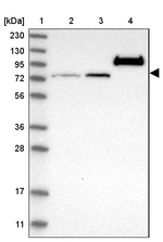 GARNL4 Antibody in Western Blot (WB)