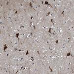 GARNL4 Antibody in Immunohistochemistry (IHC)