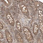 WDR85 Antibody in Immunohistochemistry (IHC)
