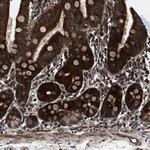 PRR15L Antibody in Immunohistochemistry (Paraffin) (IHC (P))