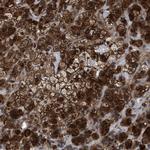 MRPL50 Antibody in Immunohistochemistry (Paraffin) (IHC (P))