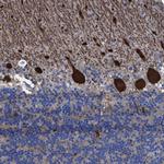 TXNL5 Polyclonal Antibody