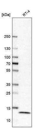 TXNL5 Antibody in Western Blot (WB)