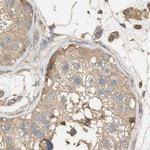 DCAF7 Antibody in Immunohistochemistry (IHC)