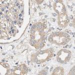 DCAF7 Antibody in Immunohistochemistry (IHC)
