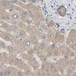 DCAF7 Antibody in Immunohistochemistry (IHC)