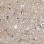 DCAF7 Antibody in Immunohistochemistry (IHC)