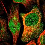 C17orf49 Polyclonal Antibody